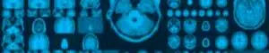 BG-brain-1100